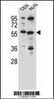 Cysteine Sulfinic Acid Decarboxylase antibody, 56-037, ProSci, Western Blot image 