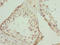 Calcium Binding And Coiled-Coil Domain 1 antibody, LS-C675451, Lifespan Biosciences, Immunohistochemistry paraffin image 