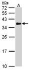 Voltage Dependent Anion Channel 1 antibody, LS-C186351, Lifespan Biosciences, Western Blot image 