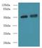 Chromobox 2 antibody, LS-B15160, Lifespan Biosciences, Western Blot image 