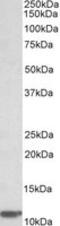 Beta-2-Microglobulin antibody, MBS423096, MyBioSource, Western Blot image 