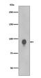 Ribosomal Protein S6 Kinase A1 antibody, P01058-2, Boster Biological Technology, Western Blot image 