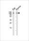 CD19 antibody, 58-121, ProSci, Western Blot image 