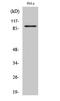 PiggyBac Transposable Element Derived 1 antibody, A12083-1, Boster Biological Technology, Western Blot image 