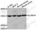 AlkB Homolog 4, Lysine Demethylase antibody, A2315, ABclonal Technology, Western Blot image 