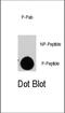 TSC Complex Subunit 2 antibody, abx032001, Abbexa, Western Blot image 