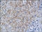 nm23-H2 antibody, 251444, Abbiotec, Immunohistochemistry paraffin image 