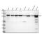 Nuclear Factor Kappa B Subunit 2 antibody, M01228-1, Boster Biological Technology, Western Blot image 