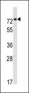 Anti-Mullerian Hormone Receptor Type 2 antibody, MBS9200710, MyBioSource, Western Blot image 