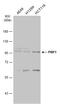 Progesterone-induced-blocking factor 1 antibody, GTX115423, GeneTex, Western Blot image 