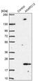 Anaphase Promoting Complex Subunit 13 antibody, PA5-61154, Invitrogen Antibodies, Western Blot image 