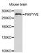 Phosphoinositide Kinase, FYVE-Type Zinc Finger Containing antibody, STJ28772, St John