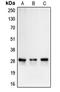 Carbonic Anhydrase 2 antibody, LS-C351900, Lifespan Biosciences, Western Blot image 