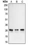 CA-II antibody, LS-C351900, Lifespan Biosciences, Western Blot image 