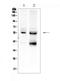 Transforming Growth Factor Beta Receptor 1 antibody, PB9828, Boster Biological Technology, Western Blot image 