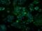 Aldehyde Dehydrogenase 2 Family Member antibody, MA5-24969, Invitrogen Antibodies, Immunocytochemistry image 