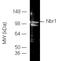 Next to BRCA1 gene 1 protein antibody, BML-PW1125-0100, Enzo Life Sciences, Western Blot image 