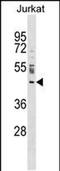 Nucleoporin 43 antibody, PA5-48845, Invitrogen Antibodies, Western Blot image 