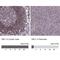 NSL1 Component Of MIS12 Kinetochore Complex antibody, NBP2-13678, Novus Biologicals, Immunohistochemistry paraffin image 