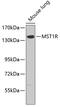 Macrophage Stimulating 1 Receptor antibody, 13-211, ProSci, Western Blot image 