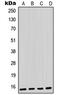 PVA antibody, MBS821228, MyBioSource, Western Blot image 