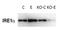Endoplasmic Reticulum To Nucleus Signaling 1 antibody, NB100-2324, Novus Biologicals, Western Blot image 