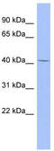 Complement Factor Properdin antibody, TA337678, Origene, Western Blot image 