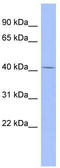 Properdin antibody, TA337678, Origene, Western Blot image 