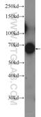 Kelch Like Family Member 41 antibody, 25577-1-AP, Proteintech Group, Western Blot image 