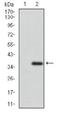 ATP Binding Cassette Subfamily G Member 5 antibody, NBP2-23488, Novus Biologicals, Western Blot image 