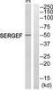 Secretion Regulating Guanine Nucleotide Exchange Factor antibody, TA315324, Origene, Western Blot image 