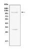 Toll Like Receptor Adaptor Molecule 1 antibody, PA1902, Boster Biological Technology, Western Blot image 