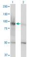 Helicase, Lymphoid Specific antibody, H00003070-M01, Novus Biologicals, Western Blot image 