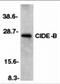 Cell Death Inducing DFFA Like Effector B antibody, 2091, ProSci, Western Blot image 