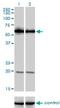 Phosphoinositide Kinase, FYVE-Type Zinc Finger Containing antibody, H00200576-M01, Novus Biologicals, Western Blot image 