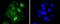 Signal Transducer And Activator Of Transcription 5A antibody, A01087-1, Boster Biological Technology, Immunocytochemistry image 