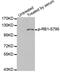 RB Transcriptional Corepressor 1 antibody, MBS125305, MyBioSource, Western Blot image 