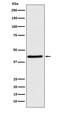 WNT Inhibitory Factor 1 antibody, M03247-1, Boster Biological Technology, Western Blot image 