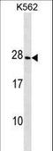 Crystallin Gamma D antibody, LS-C159412, Lifespan Biosciences, Western Blot image 