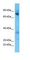 Threonyl-TRNA Synthetase antibody, orb325268, Biorbyt, Western Blot image 