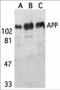 Amyloid Beta Precursor Protein antibody, 2133, ProSci Inc, Western Blot image 