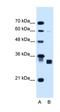 Carbonyl Reductase 1 antibody, orb330451, Biorbyt, Western Blot image 