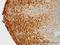 Keratin 81 antibody, H00003887-M01, Novus Biologicals, Immunohistochemistry paraffin image 