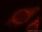 Electron transfer flavoprotein subunit alpha, mitochondrial antibody, 12262-1-AP, Proteintech Group, Immunofluorescence image 