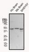 Glucagon Like Peptide 1 Receptor antibody, NBP1-97308, Novus Biologicals, Western Blot image 