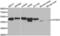 Ataxin 3 antibody, abx001155, Abbexa, Western Blot image 