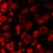 Acid Sensing Ion Channel Subunit 2 antibody, A04055, Boster Biological Technology, Immunofluorescence image 