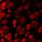 Amiloride-sensitive cation channel 1, neuronal antibody, A04055, Boster Biological Technology, Immunofluorescence image 