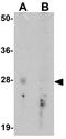 GLIPR1 Like 2 antibody, GTX32129, GeneTex, Western Blot image 