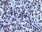 PLU-1 antibody, NBP1-97310, Novus Biologicals, Immunohistochemistry paraffin image 